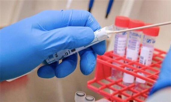 مراکز نمونه‌گیری تست کرونا در دزفول افزایش یافت