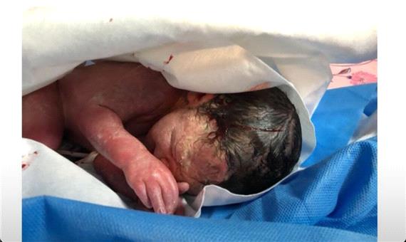 تولد نوزاد سالم در هنگامه کرونا در بیمارستان رازی اهواز