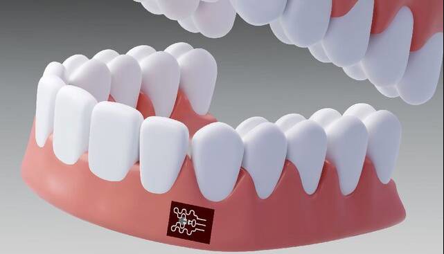 تشخیص التهاب لثه فقط با یک برچسب!